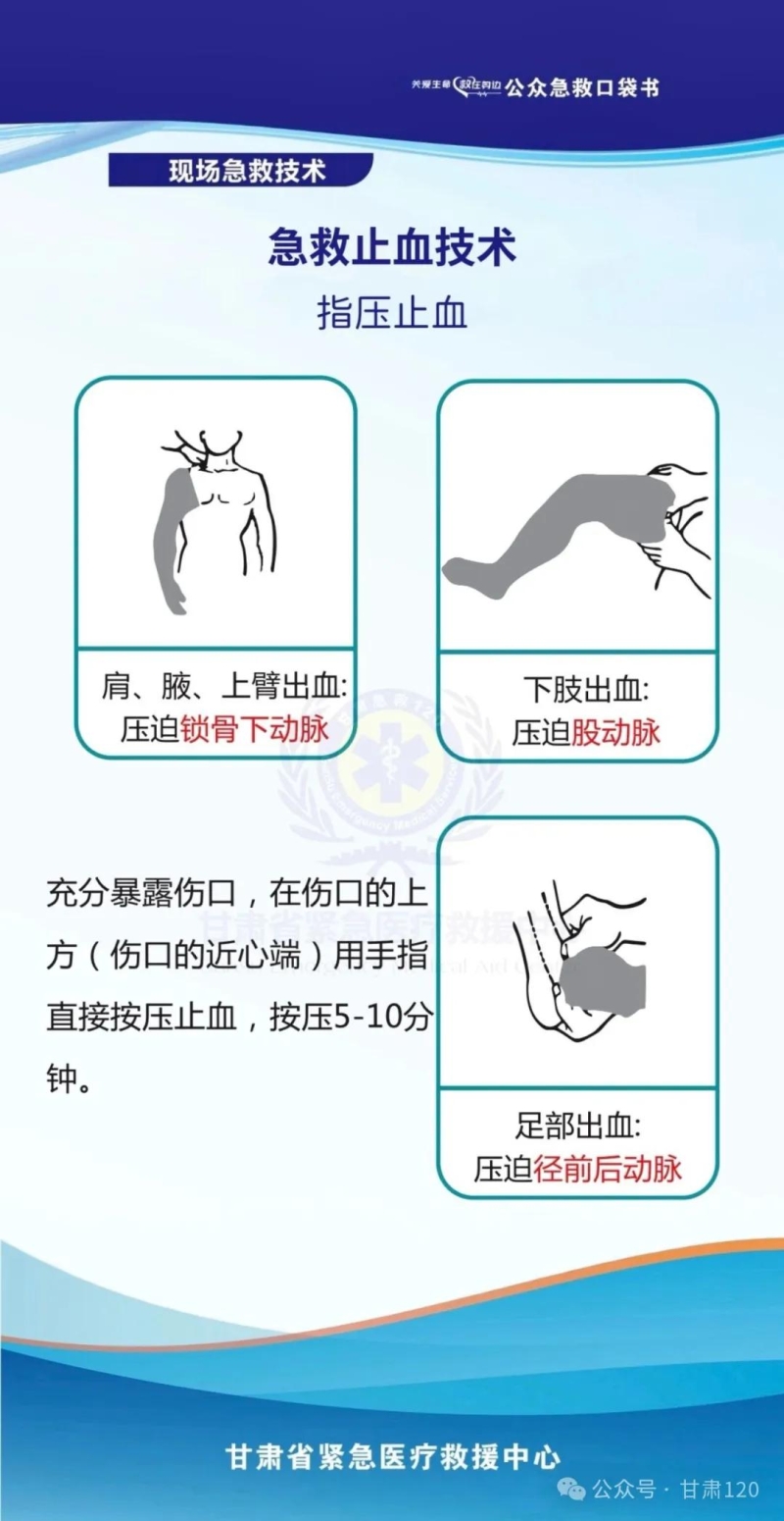 把急救知识装进口袋丨急救止血技术·指压止血