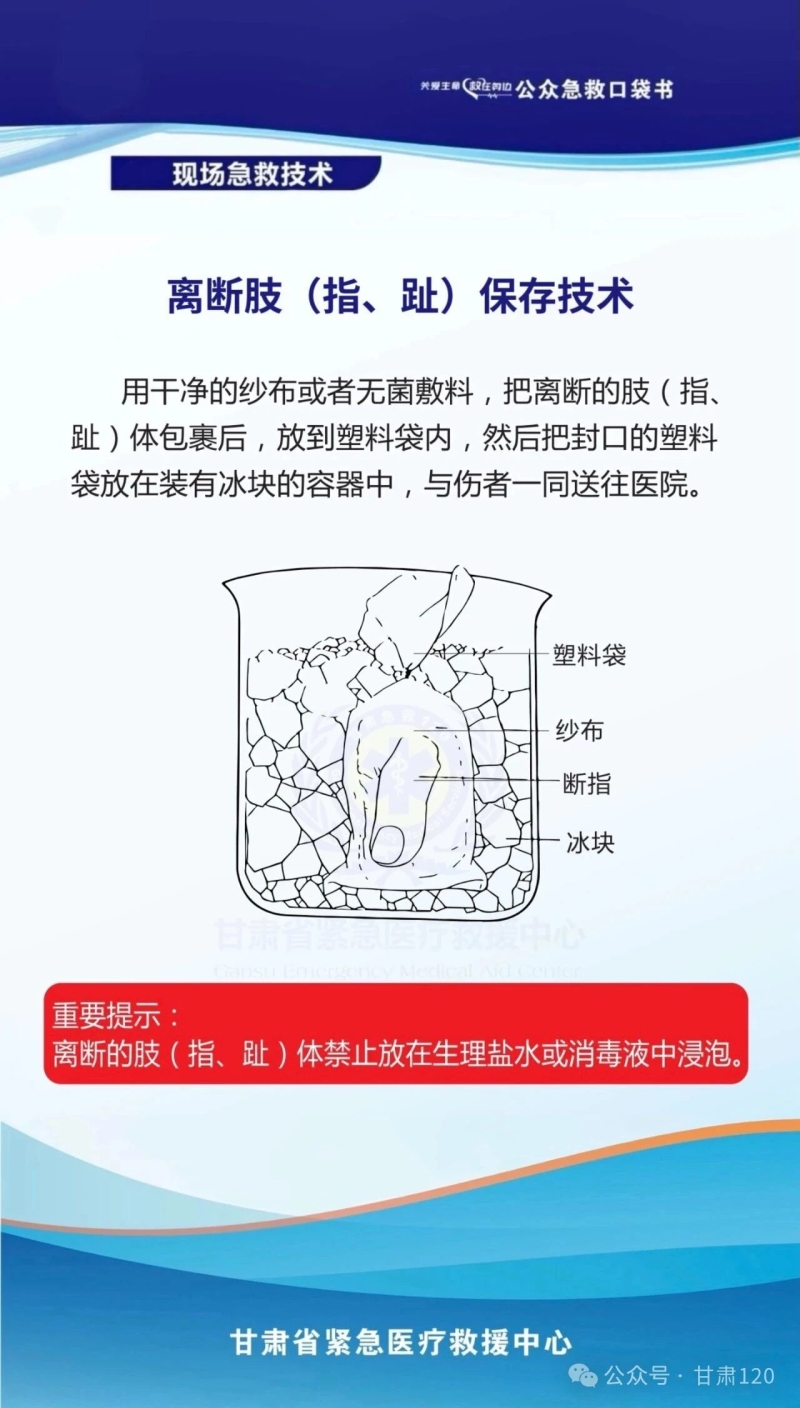 把急救知识装进口袋丨离断肢（指、趾）保存技术