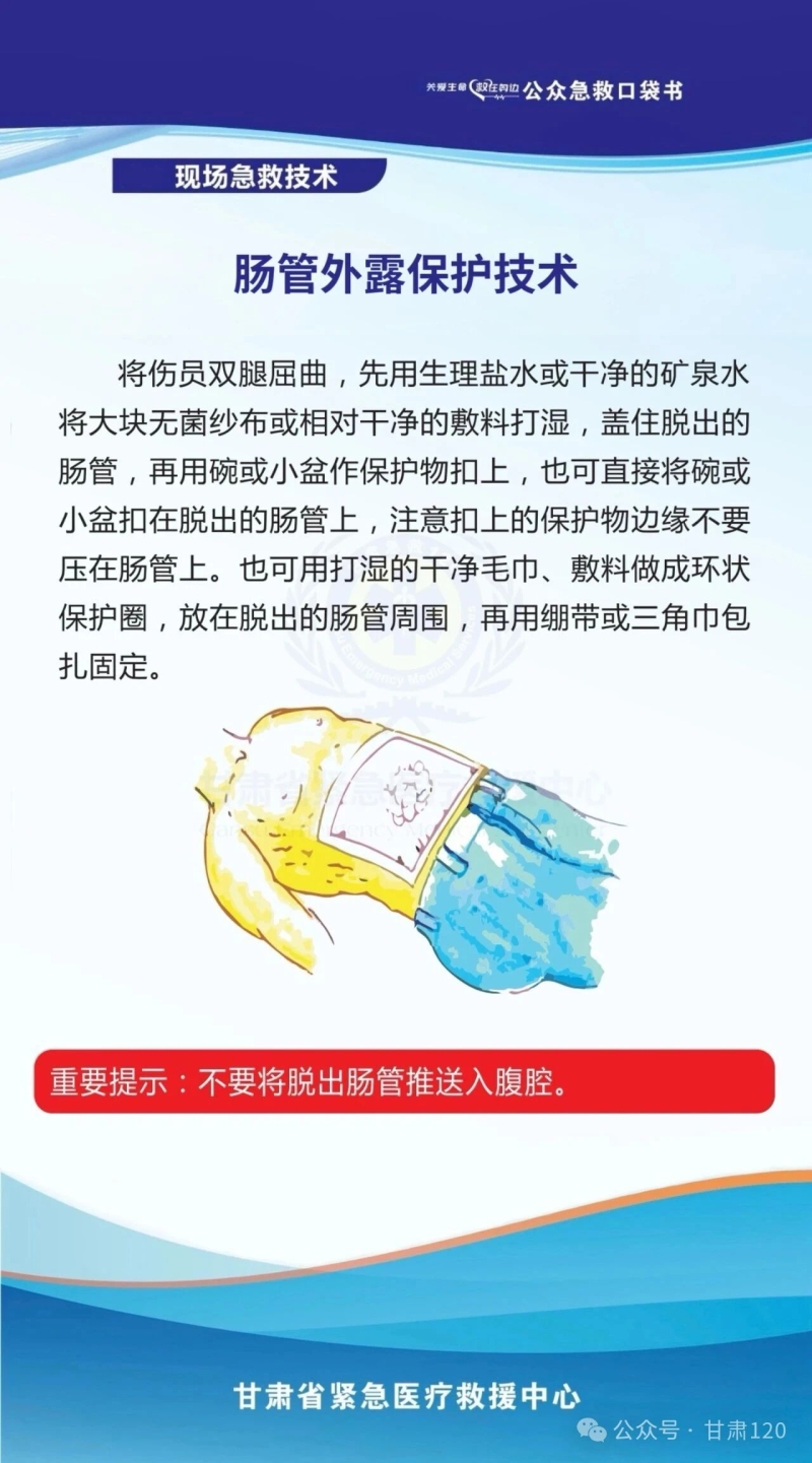 把急救知识装进口袋丨肠管外露保护技术